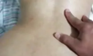 Suro anal prolapse k ...