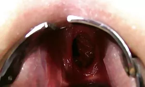 Anal fisting indi, p ...