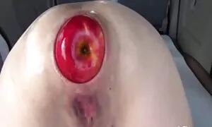 Anal fisting zauro x ...